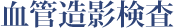 Ǒe
