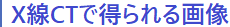 XCTœ摜