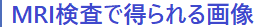 MRIœ摜